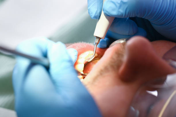 Best Emergency Dental Services for Seniors in Gladeview, FL