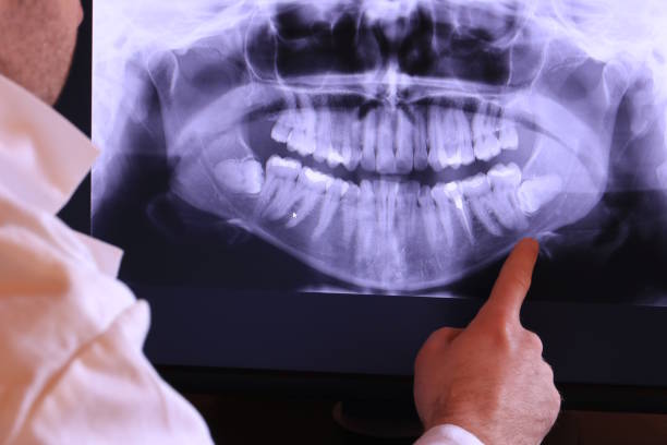 Best Emergency Dentist for Knocked-Out Tooth in Gladeview, FL