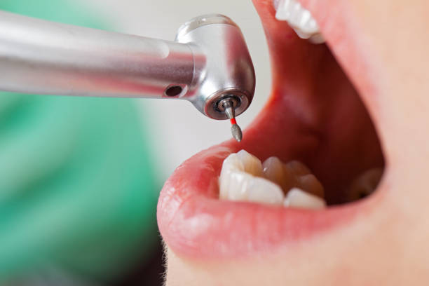 Best Emergency Dental Care for Abscessed Tooth in Gladeview, FL